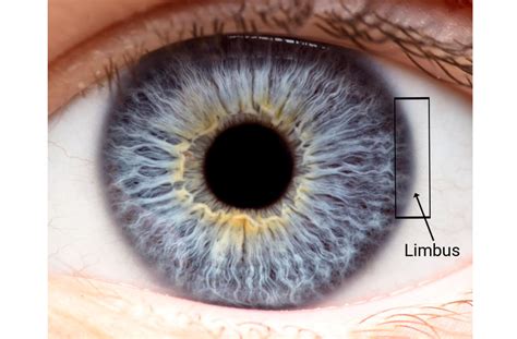 iris thickness measurement|how thick is a limbus eye.